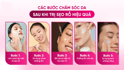 Da mặt bị sẹo rỗ nên làm cách nào?