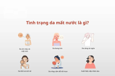 Dấu hiệu da bị mất nước: duy trì độ ẩm đúng lúc