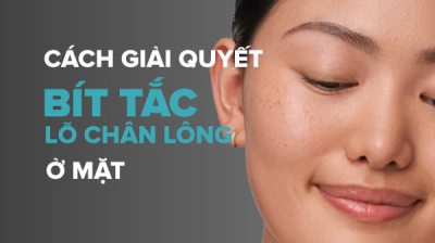 Làm sạch da mặt: Giải thoát sự bí bách cho lỗ chân lông