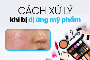 Dấu hiệu da dị ứng mỹ phẩm và cách xử lý