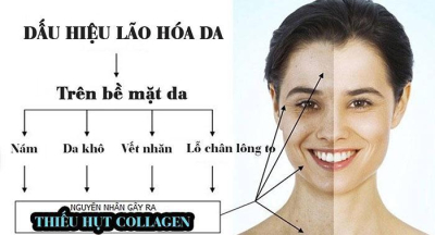Các yếu tố hình thành sự lão hóa và cách ngăn ngừa lão hoá da