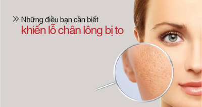 Nguyên nhân làm lỗ chân lông bị to và cách khắc phục
