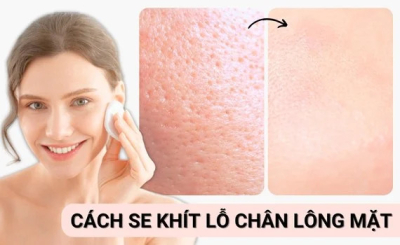 Bật mí những cách giúp se khít lỗ chân lông nên thử