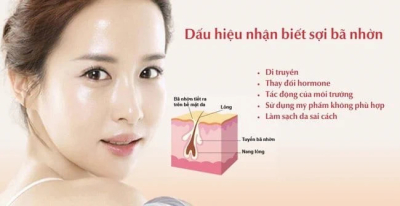 Chất nhờn trên da có tác dụng gì - Có cần làm sạch không?