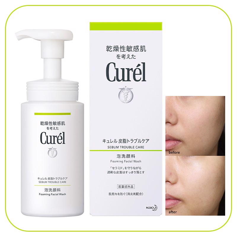 Sữa Rửa Mặt Tạo Bọt Trị Bã Nhờn Cho Da Nhạy Cảm Curél Sebum Trouble Care Foaming Facial Wash (150ml) 