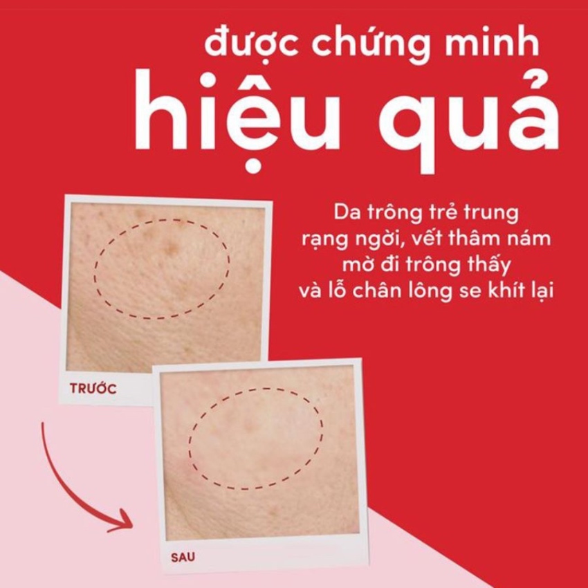 Kem Dưỡng Da & Ngăn Ngừa Lão Hóa Cho Ban Ngày Pond's Age Miracle Day Cream (50g)