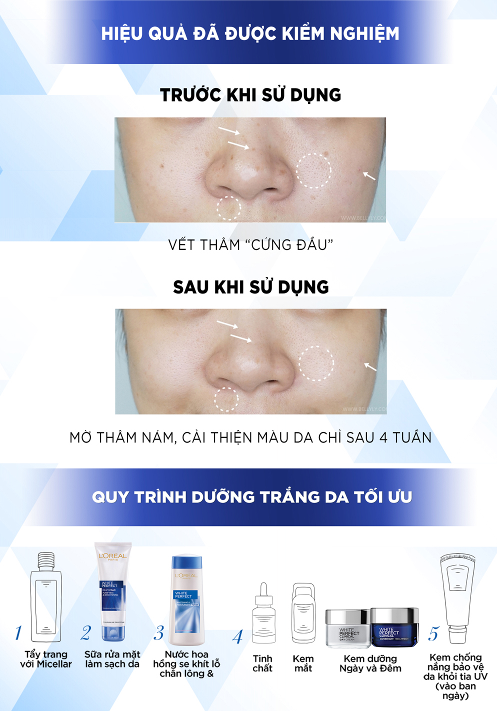 Kem Dưỡng Da Trắng Mịn, Giảm Thâm Nám Ban Đêm L'Oréal White/Aura Perfect Clinical Overnight (50ml) 