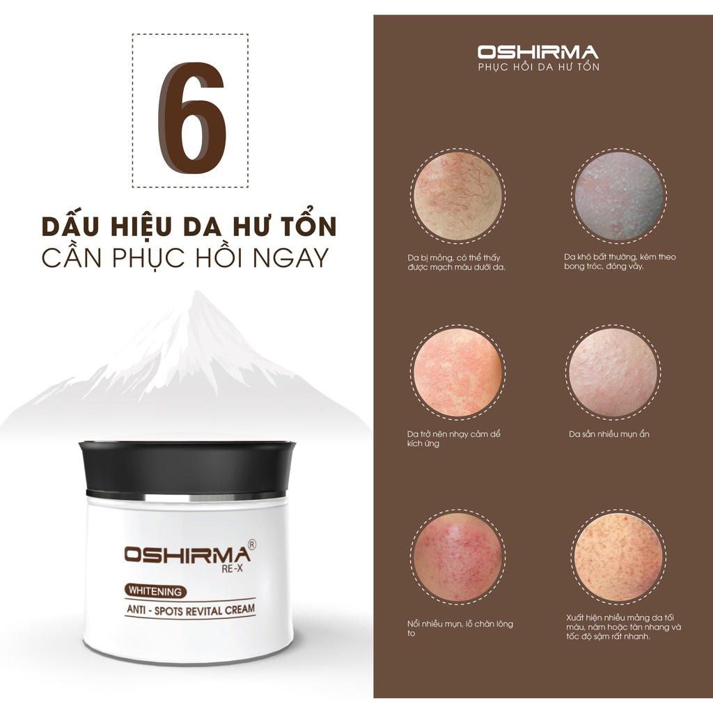 Kem Dưỡng & Bổ Sung Độ Ẩm Cho Da Oshirma Re-X Whitening Anti-Spots Revital Cream (10g )